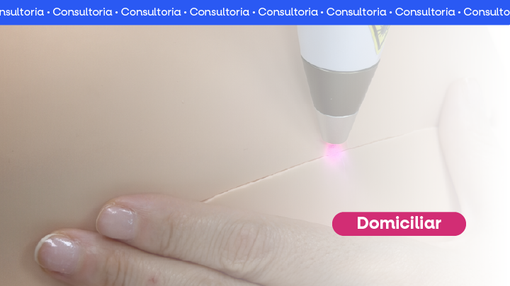 Laserterapia no p�s parto - domiciliar